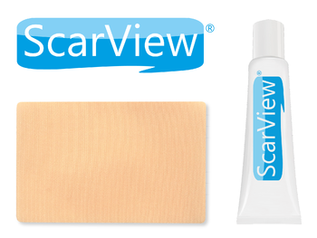 ScarView